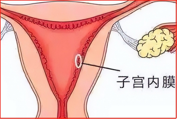 子宫内膜厚度会影响试管婴儿的成功率