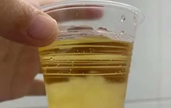 网传怀孕45天可以用白醋100%准确测试男孩女孩可信吗？