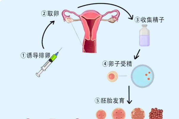 三代试管可以筛查基因