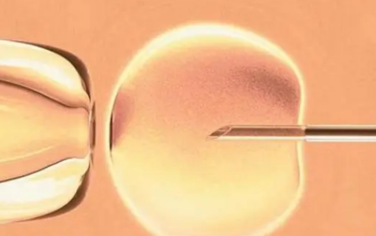 开封医学科学研究所附属医院试管成功率在50%左右
