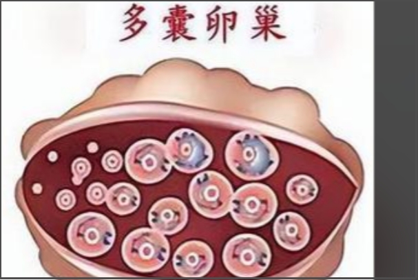 多囊打促排针效果因人而异