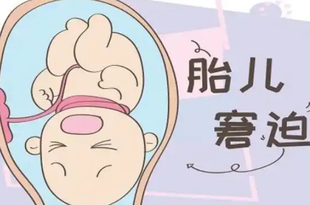 胎儿窘迫常见原因，包括妊娠期高血压、胎盘早剥等