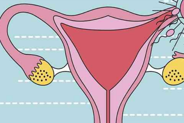 子宫内膜薄会导致胚胎着床困难