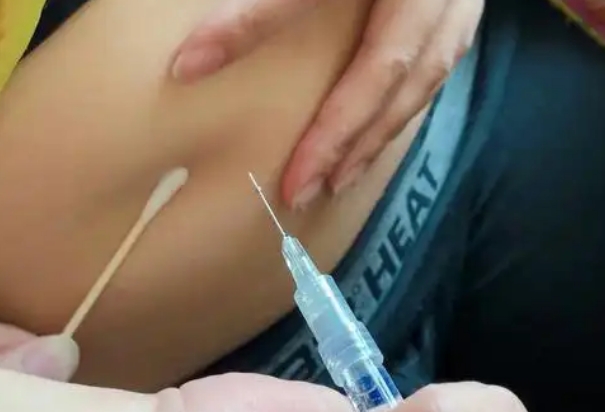 排卵针可以打腹部区域