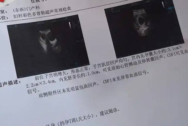 胚胎移植着床成功后最晚多久能看到胎心胎芽？