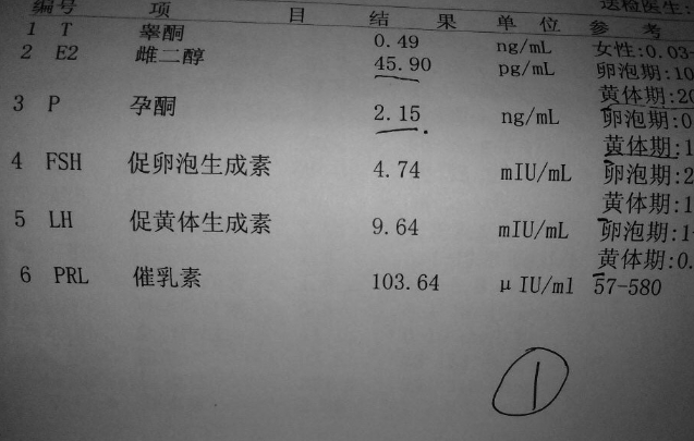 女性性激素六项检查哪项结果不正常最严重？