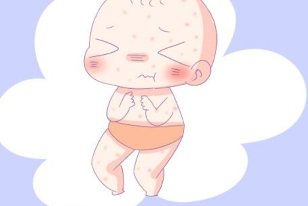 有些孩子吃了益生菌会过敏