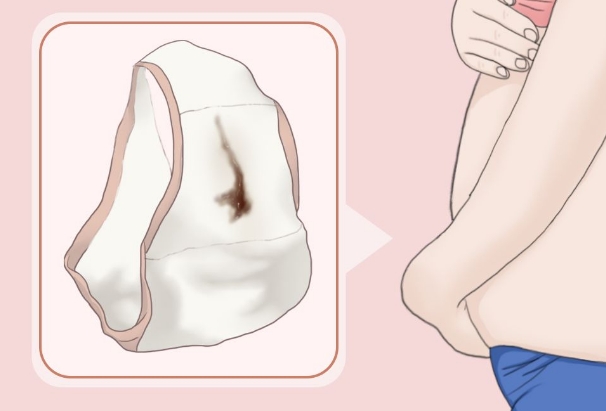 胚胎着床会有出血的情况