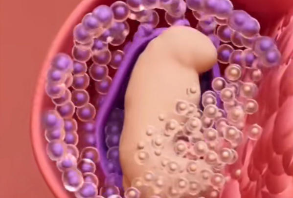 试管婴儿移植后多久算稳定？从验孕到分娩的五个关键阶段解析