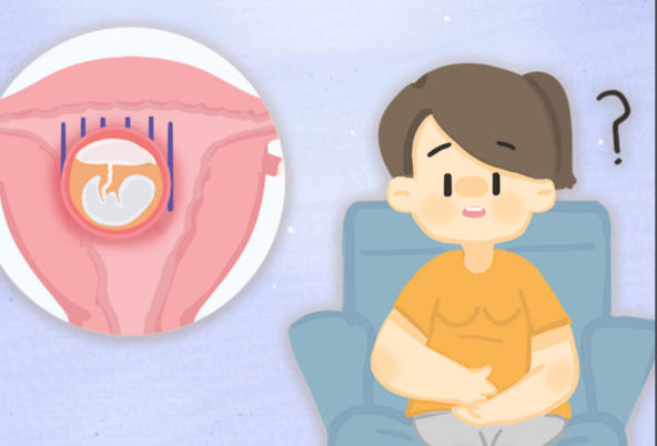 试管移植后可以适当活动