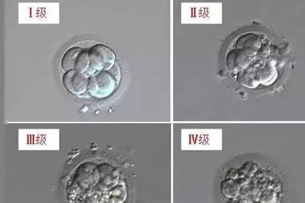 囊胚级别高低会影响宝宝智力是假的
