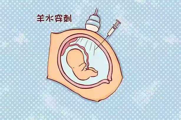 羊水穿刺第17天了还没有接到医院的电话正常吗？