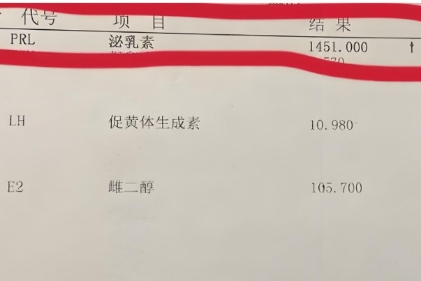 泌乳素高了怎么备孕，通过药物控制使其降低