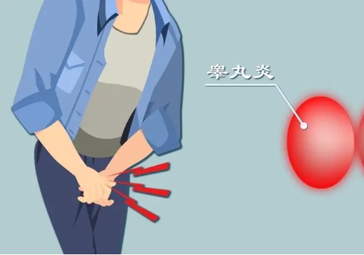精子质量差会导致不育