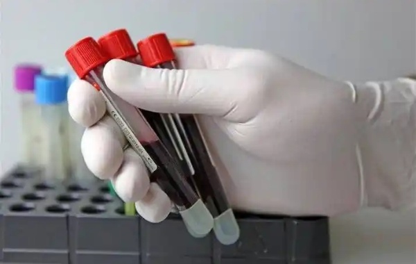 网传怀孕35天可以看hcg数值辨别男孩还是女孩可信吗？