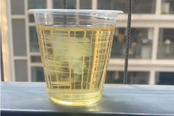 尿液加醋无法判断胎儿是男是女