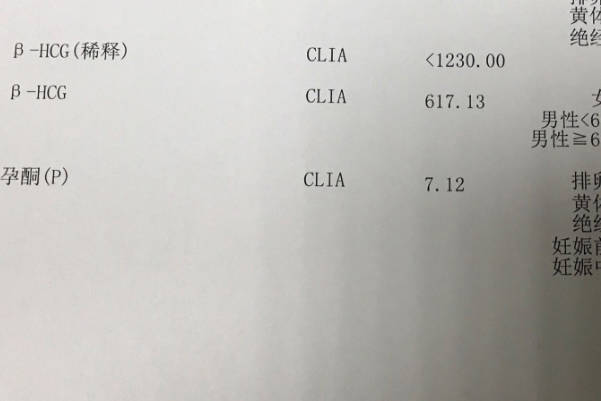 hcg值一千多可能会是双胎