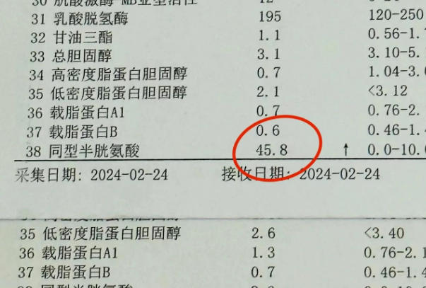 HCY检查反映机体叶酸代谢