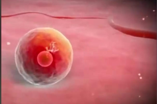 试管移植后建议卧床休息1个小时