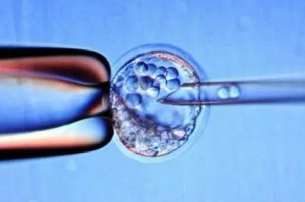 广东三代试管技术揭秘：生男孩费用及必须知道的注意事项！