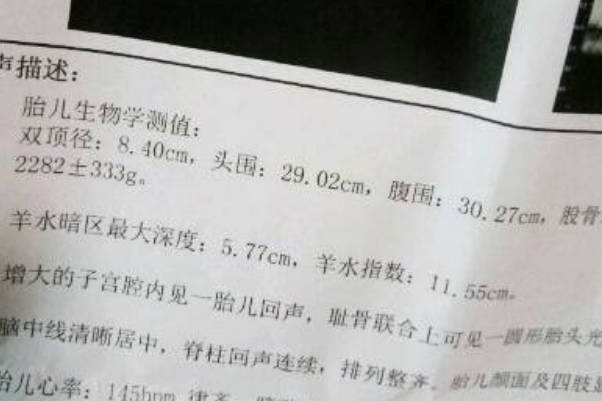 弹剑问天的胎心率为140生了男孩