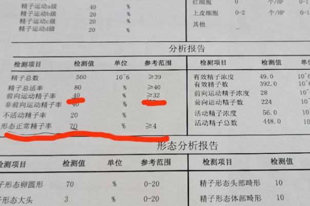 备孕男性检查什么项目，最基础的就是精液分析
