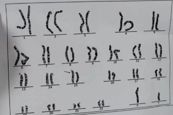 为什么有的人染色体异常却很健康，从基因到系统的多层防护