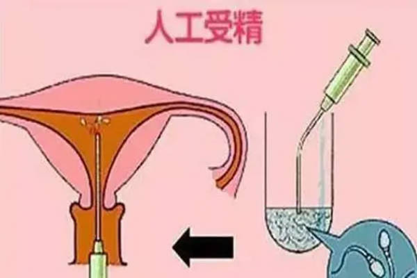 人授的优势是周期快和费用低