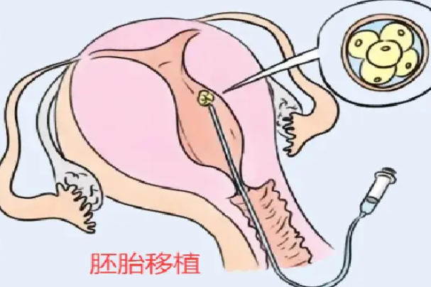 试管移植两个胚胎的成功率因人而异