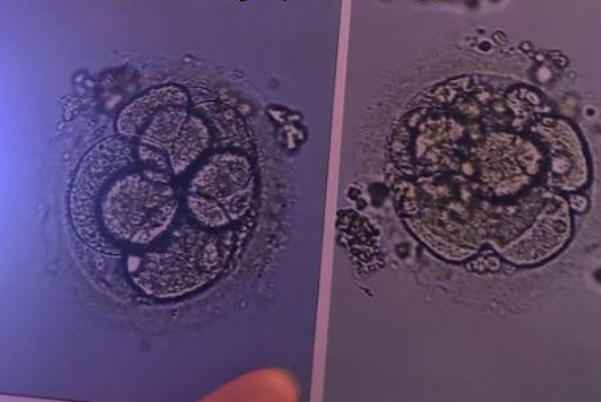 囊胚移植后黄金72小时，一文了解第三天为何成着床最关键期