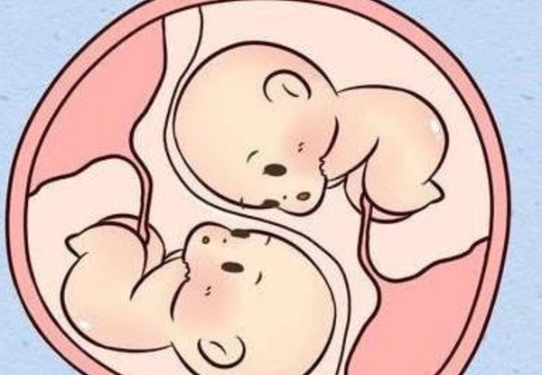 龙凤胎属于多胎妊娠