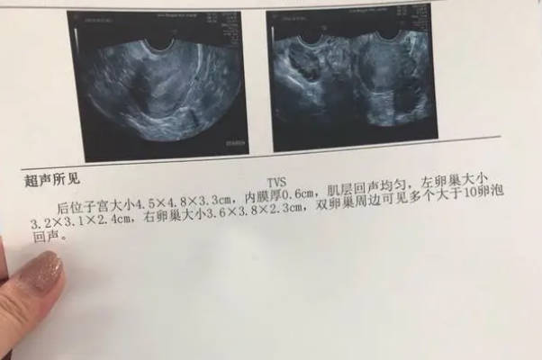 两侧排卵的情况是比较少