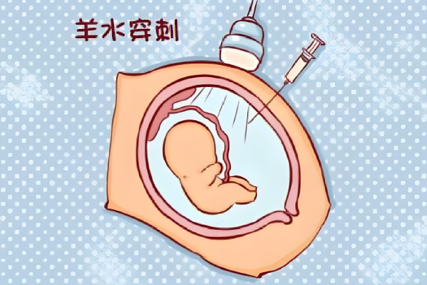 36岁女性做三代试管妊娠成功后产检必须要做羊水穿刺吗？