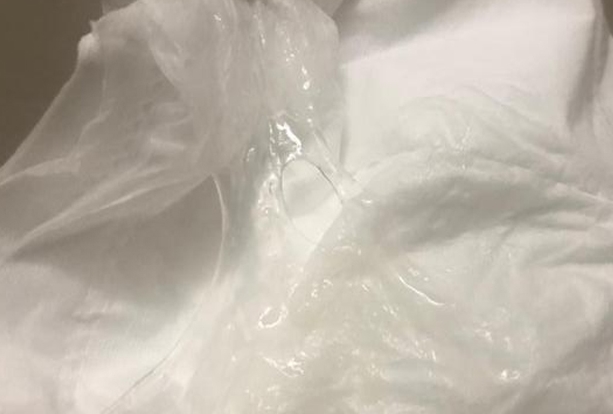怀孕后要注意休息