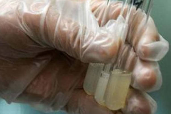 精子少能不能生孩子，男性少精弱精试管生男几率大吗