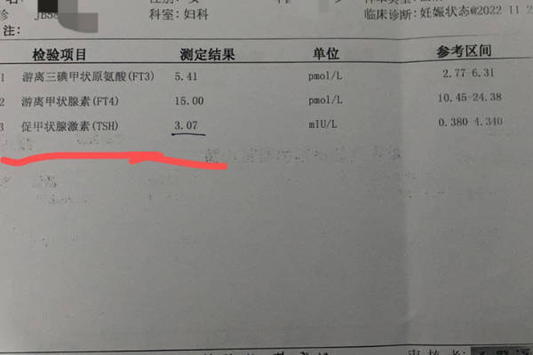 试管移植前促甲状腺素水平＞4.5：与胚胎着床关系的探究