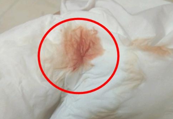 着床出血持续时间短