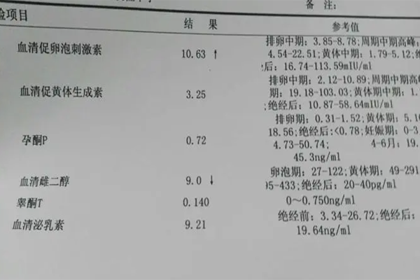 内分泌失调需要做性激素六项检查