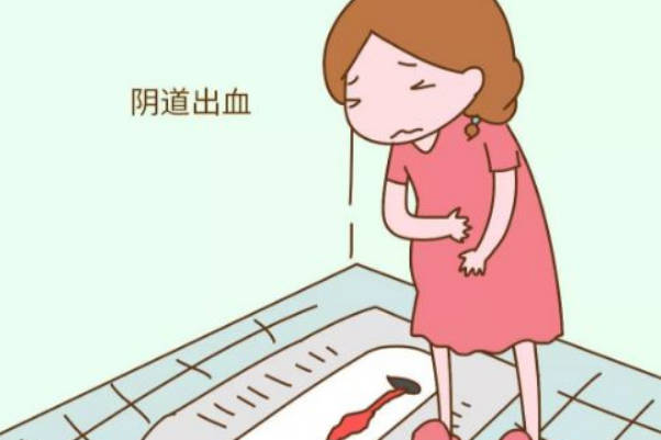 有先兆流产症状时要尽量卧床休息