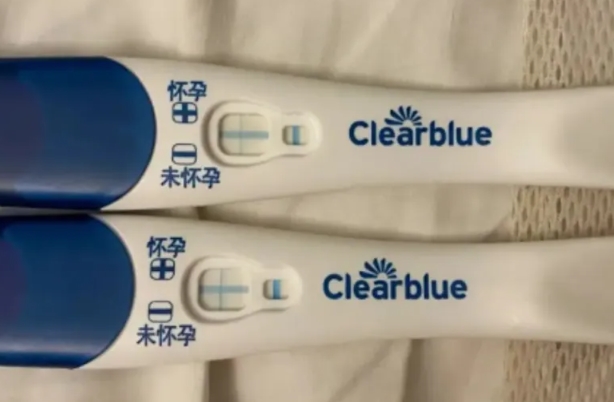 抽血验孕最准确