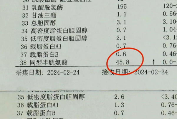 hcy检查可以判断叶酸代谢率