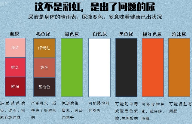 儿童尿液颜色对照图，可反应宝宝身体健康情况
