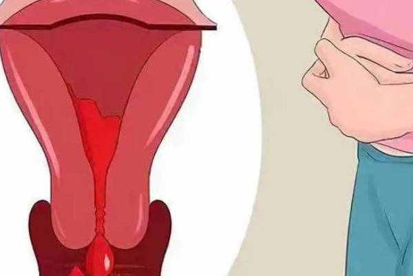子宫内膜5mm吃什么可以增厚别还不造，想调理来月经看这里