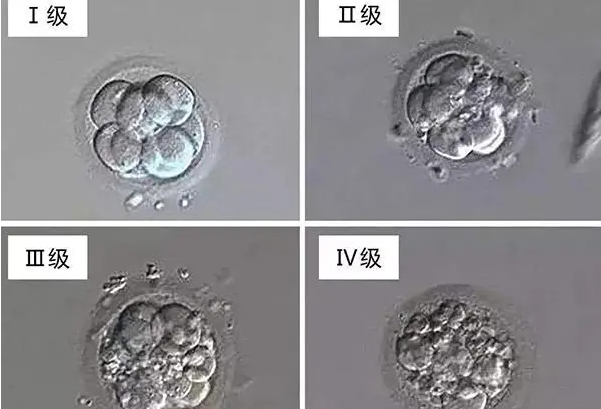 胚胎质量划分为四个等级