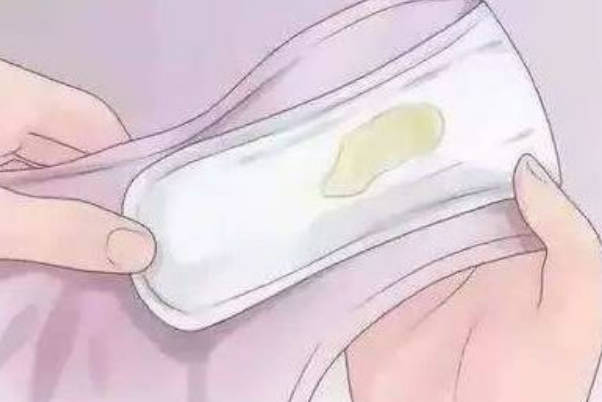 分泌物呈黄绿色脓性有臭味是滴虫感染