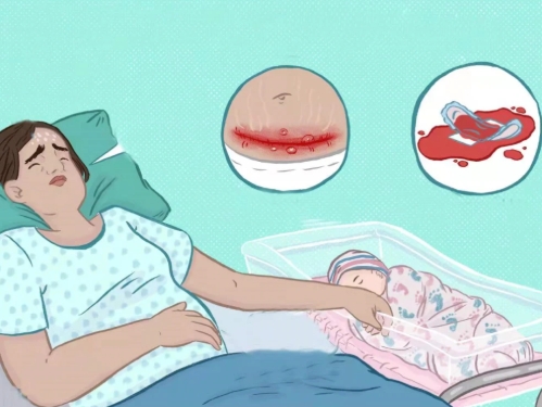 剖腹产后会产生瘢痕子宫
