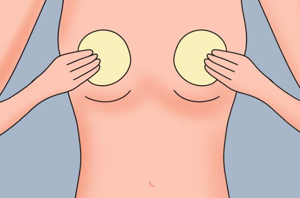 有堵奶正确使用土豆片敷乳房的图片吗？