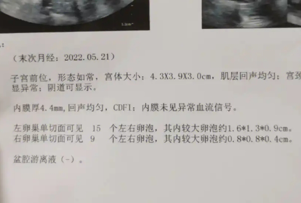 排卵监测几天去一次医院，掌握好节奏才能少跑几趟