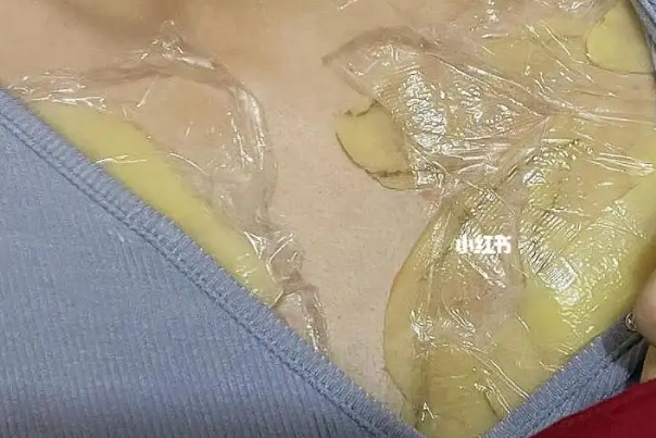 涨奶敷土豆片有消炎功效