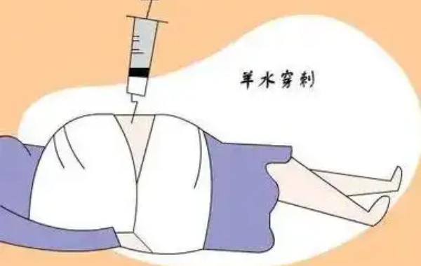 34岁女性做3代试管怀孕后羊水穿刺异常率高吗？